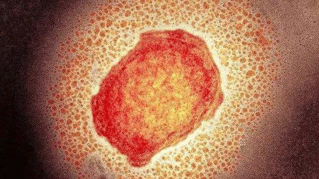 Varíola dos macacos: o que se sabe sobre rara infecção viral com mais 2 casos na Inglaterra