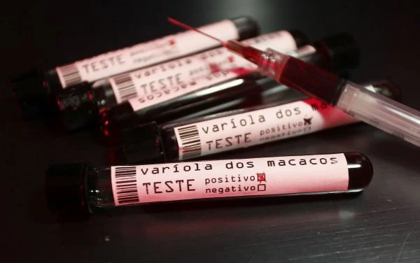 Alagoas tem mais um caso confirmado da varíola dos macacos e chega a 13; 10 são de Maceió