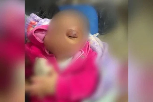 Em discussão com esposa, homem dá soco no rosto da própria filha de 1 mês