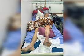 Família denuncia hospital por negligência em cirurgia de idosa com fratura no fêmur