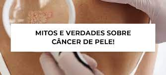 Desvendando o Câncer de Pele: Mito ou Verdade?