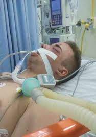 Jovem em estado grave na UTI após ser agredido por amigo no DF durante briga por ciúmes