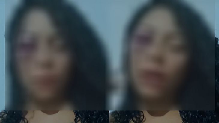 Polícia investiga agressão contra dançarina em Maceió