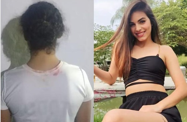 Mulher é presa após assumir ter jogado ácido em jovem