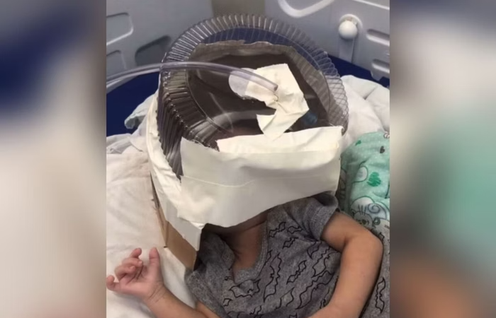 Embalagem de bolo usada em bebê salvou sua vida, diz médica