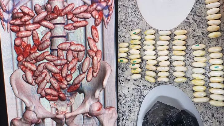 Passageiros são presos com 214 cápsulas de cocaína no estômago