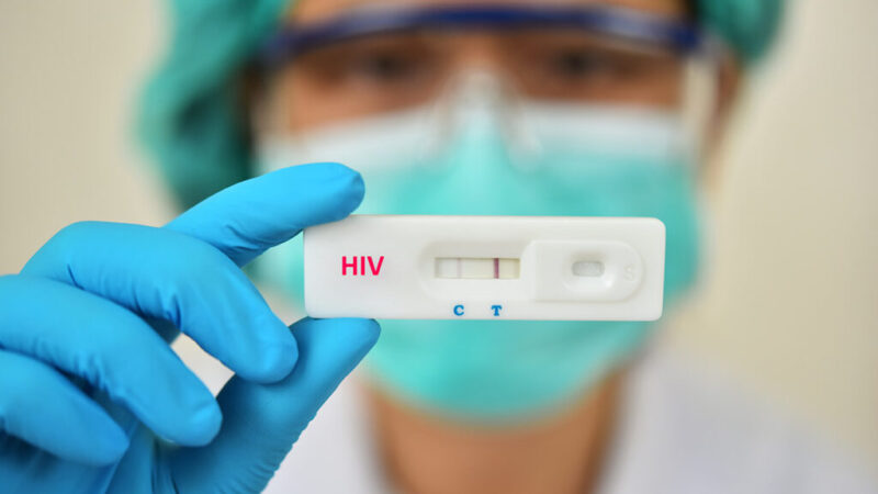 Ministério da Saúde orienta farmácias a realizar testes rápidos de HIV