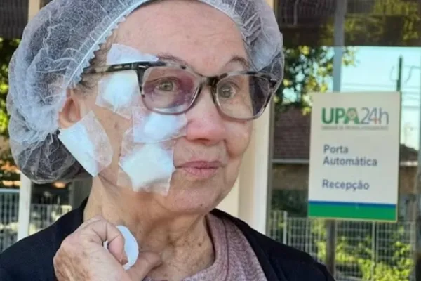 Mulher de 79 anos leva 50 pontos no rosto após ataque de pit-bull
