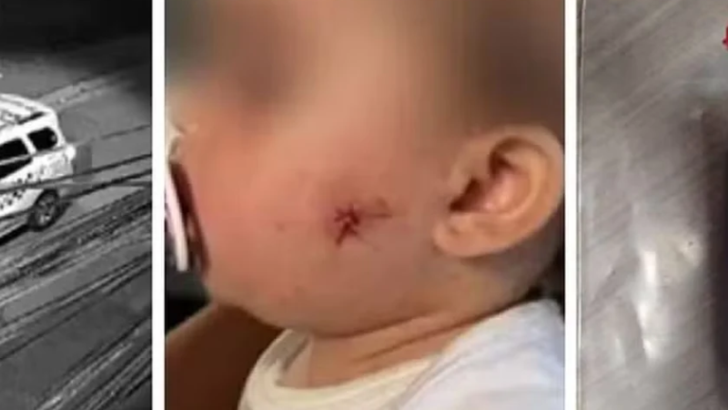 Justiça militar torna réu por lesão corporal PM acusado de dar tiro no rosto de bebê com arma de airsoft