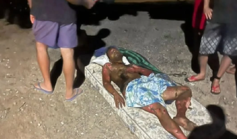 Homem ateia fogo no próprio corpo em povoado de Igreja Nova