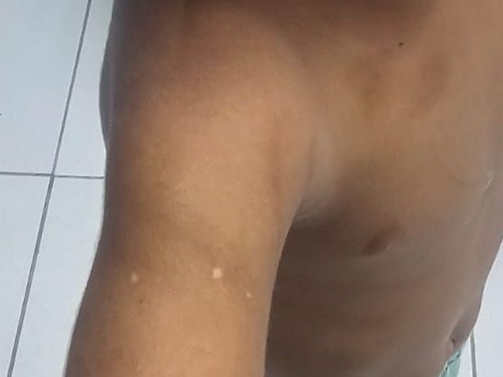 Criança de 3 anos é resgatada após denúncia de maus-tratos; mãe e padrasto têm prisão mantida pela Justiça